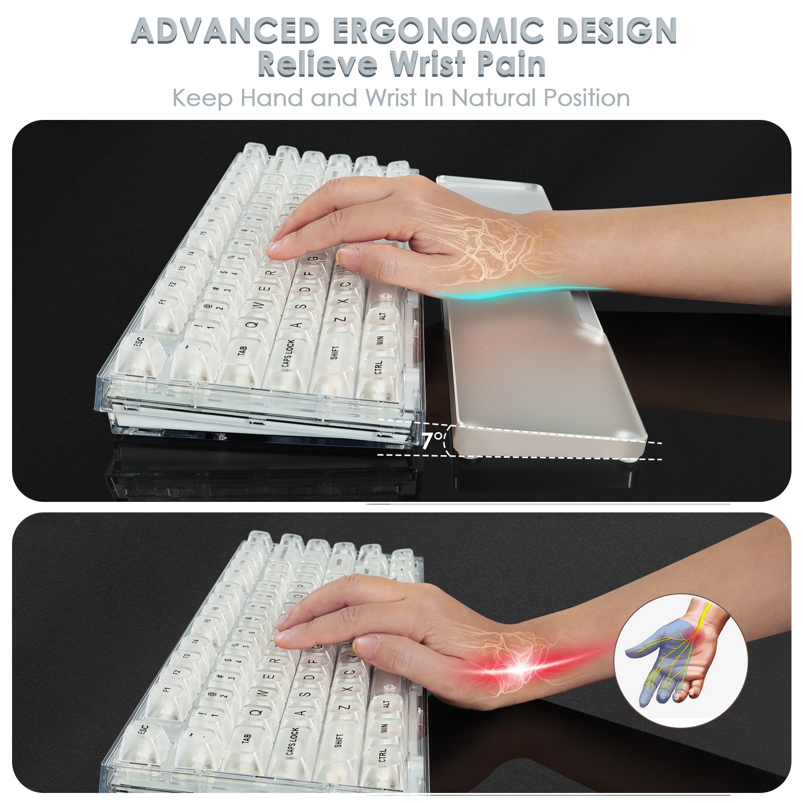 Advanced ergonomic design showing wrist pain relief with Attack Shark acrylic wrist rest.