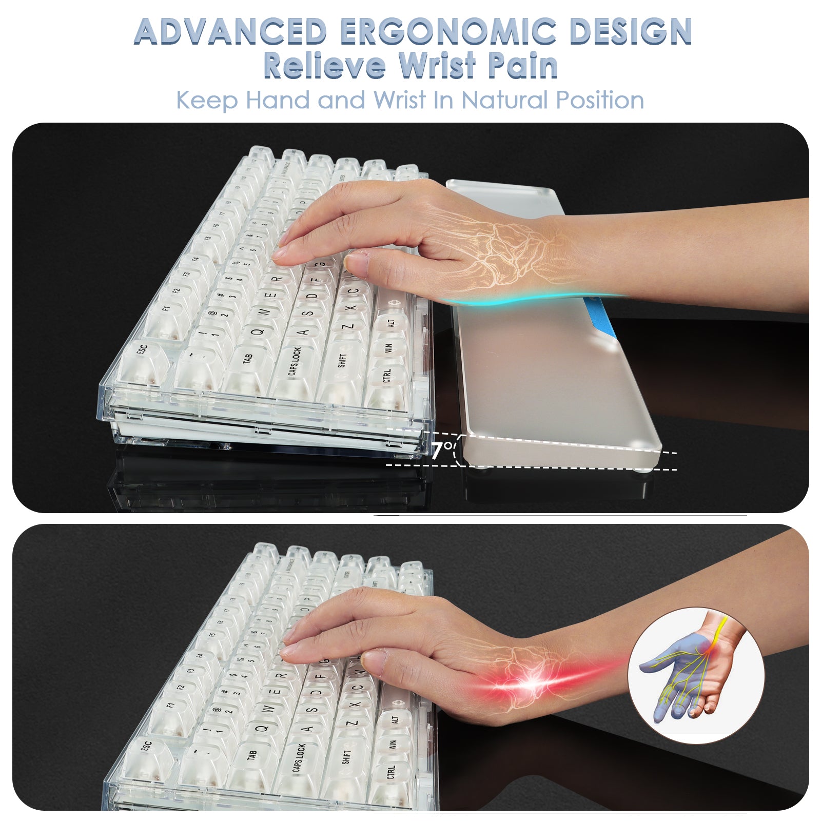 Person using a mechanical keyboard with advanced ergonomic design and acrylic wrist rest.