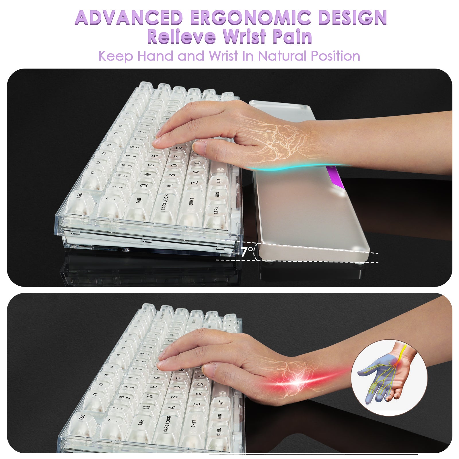 Hand on keyboard with translucent acrylic wrist rest illustrating ergonomic design benefits.